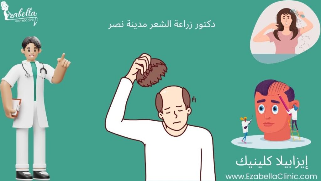 دكتور زراعة الشعر مدينة نصر